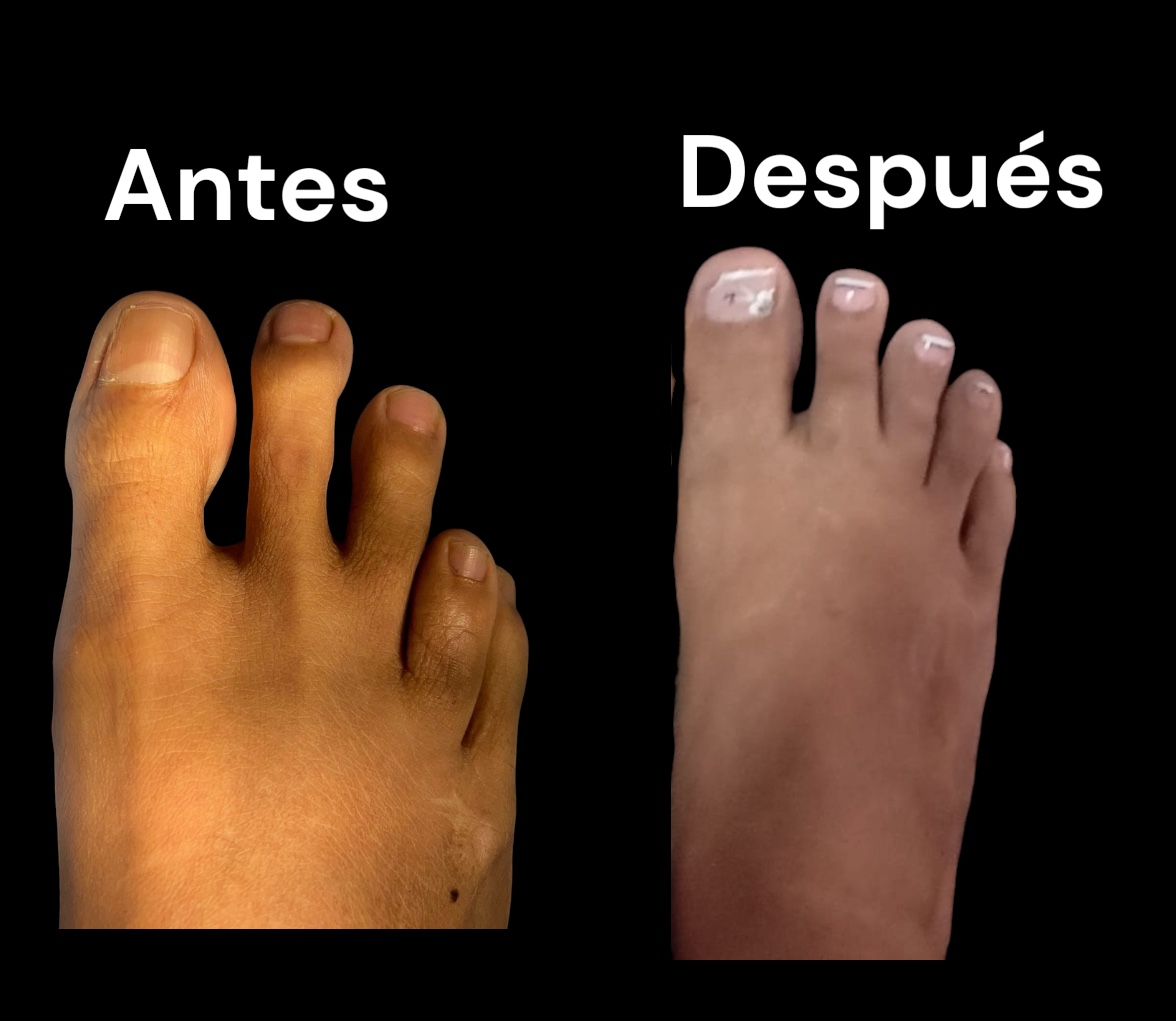 Dr. Luis Castillo, especialista en pie y tobillo